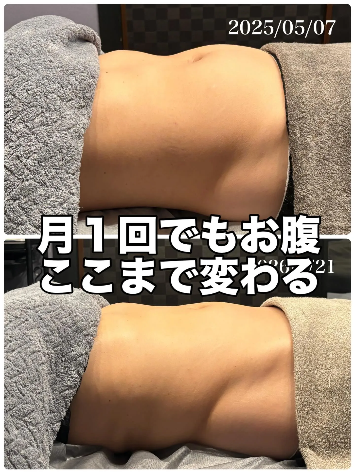 ✴︎JR川崎駅ラゾーナそばで腸もみ